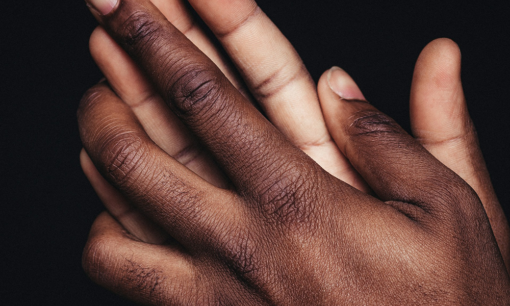 What Does Hypoallergenic Mean — And Why It Matters for Jewellery